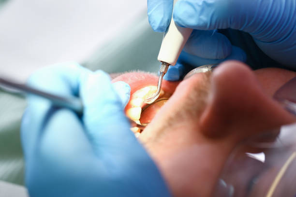 Best After-Hours Emergency Dentist in Glencoe, IL